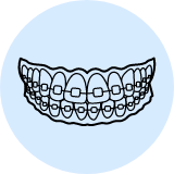 Braces & Aligners_