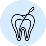 Root Canal Treatment