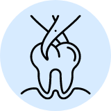 Wisdom Teeth Removal